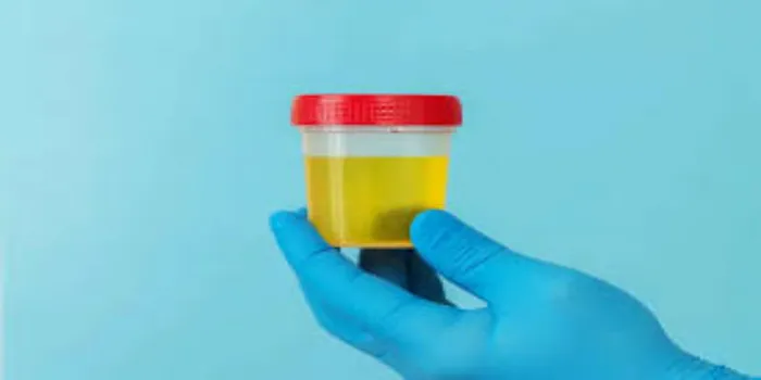 Why Does Urine Color Change During Pregnancy Period?
